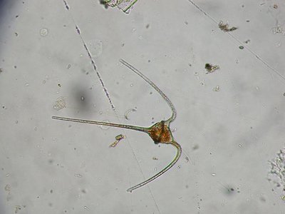 Ceratium_sp_umitunoobimusi.jpg